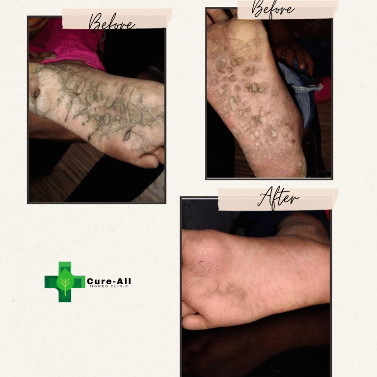 Neutral Rustic Before After Photos Instagram Post (1)